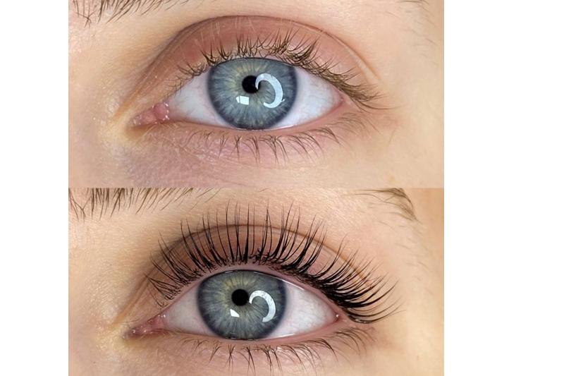 Ni�anta�� Kirpik Lifting